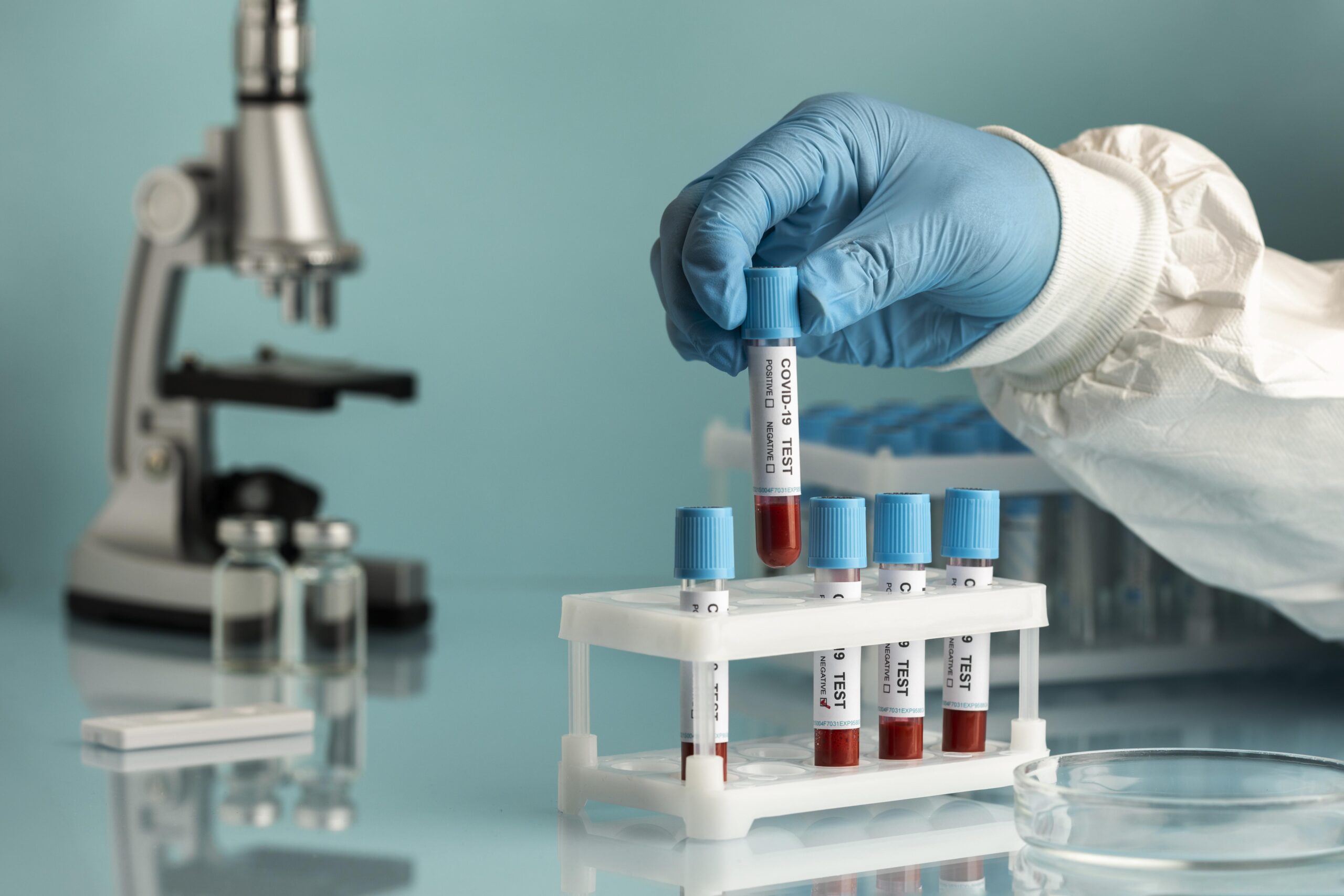 hand-with-protective-gloves-holding-blood-samples-covid-test